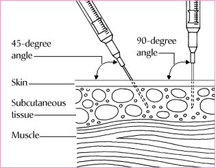Sub-Q Injection